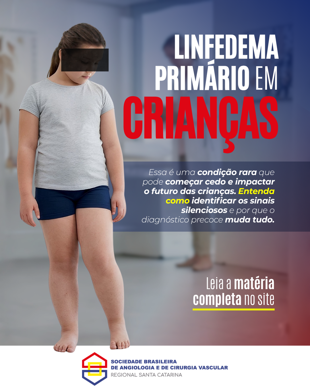 Lifedema Primário