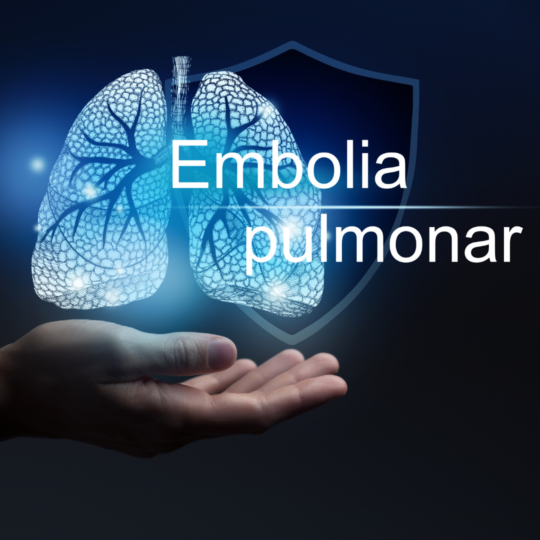 Você sabe o que é embolia pulmonar?