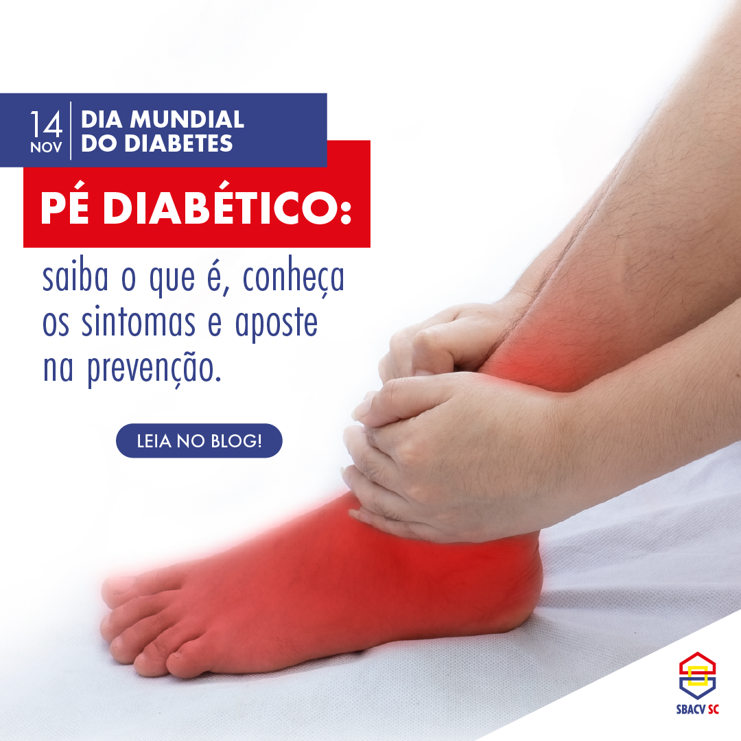 No Dia Mundial do Diabetes, alertamos sobre o pé diabético e a importância do cuidado com a saúde vascular 